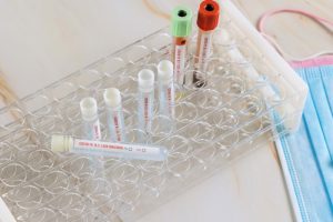 Omicron Depositphotos_533451846_S (1)