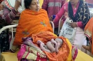 Boy born in Bihar with four legs