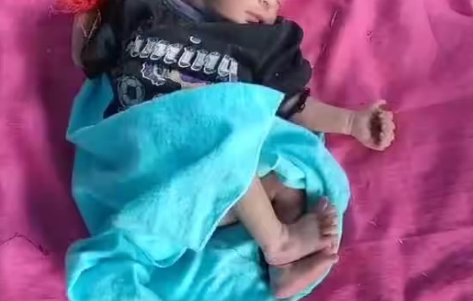 baby girl born with 6 fingers (1)