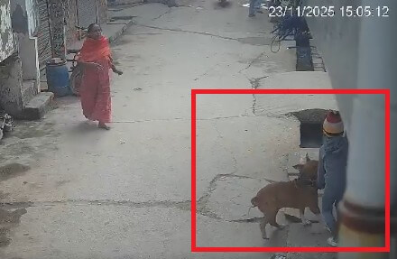 pitbull attacks child in Delhi (1)