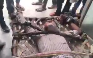 Aligarh News Dog Bite (1)