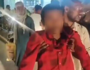 Mirzapur Dog News Dog Bites 17 Year Old (1) (1)