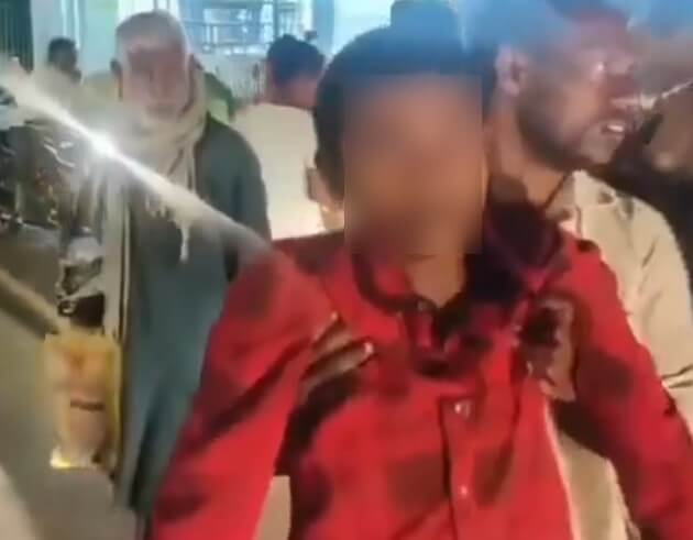 Mirzapur Dog News Dog Bites 17 Year Old (1) (1)