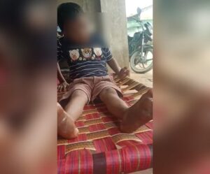 fatehpur news mother burns sons feet 2 (1)