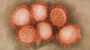 influenza a
